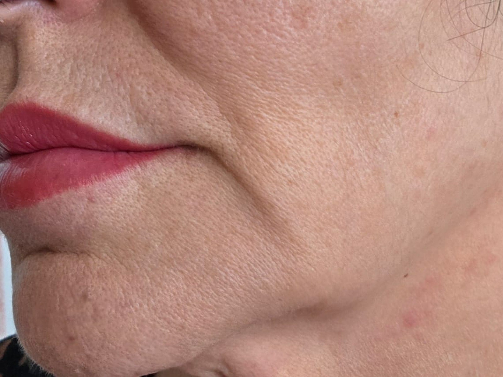 Imagem ilustrativa de contorno facial antes