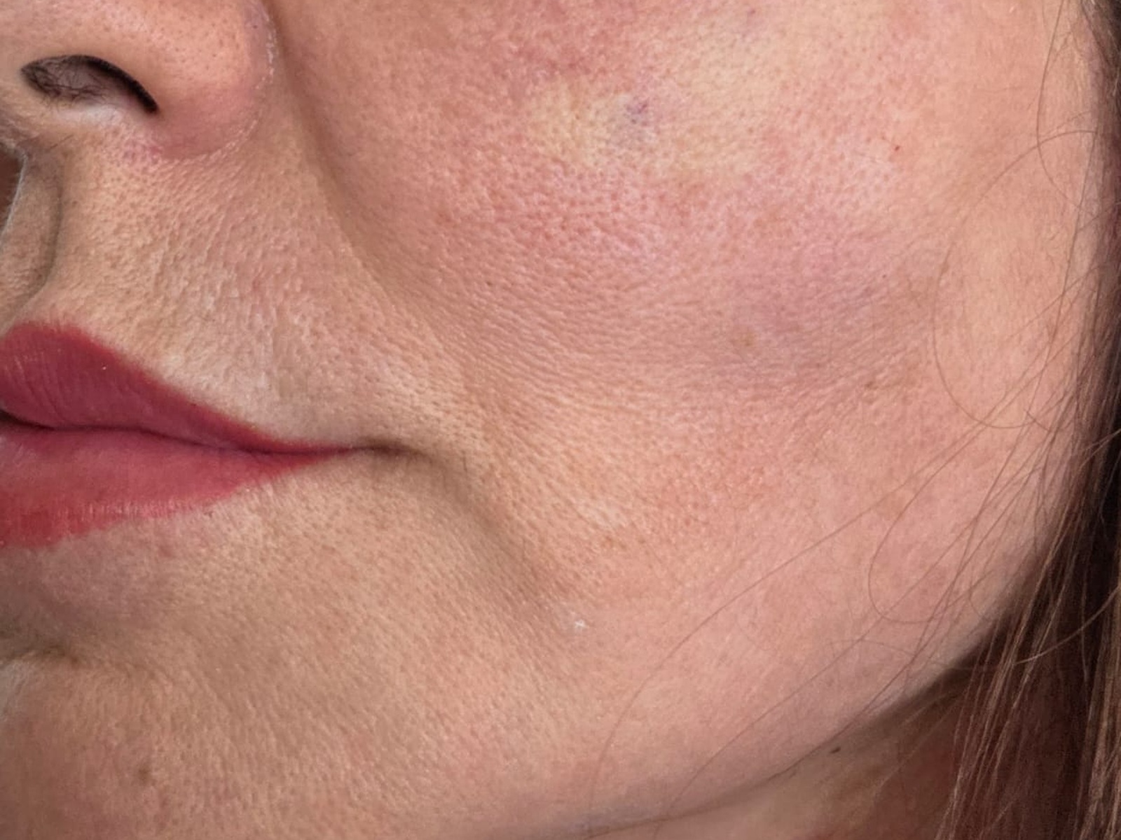 Imagem ilustrativa de contorno facial depois