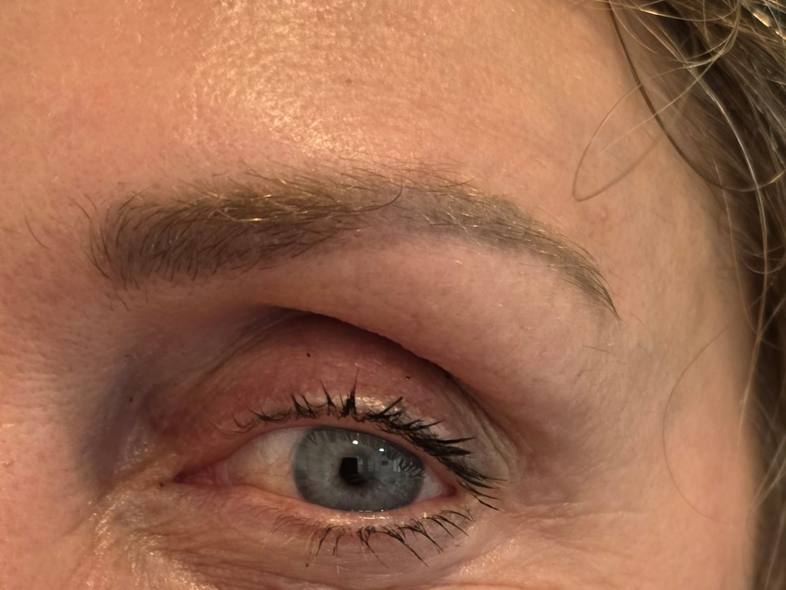 Imagem ilustrativa de perfil facial depois