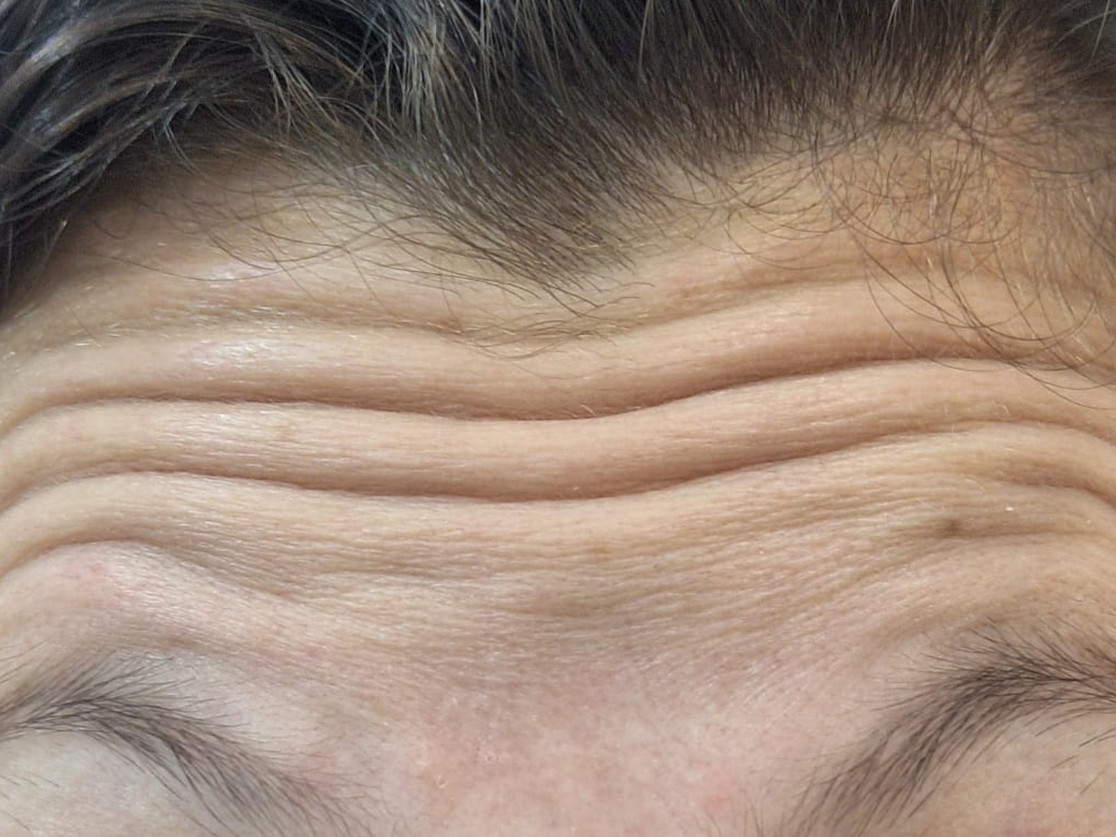 Imagem ilustrativa de equilíbrio facial antes