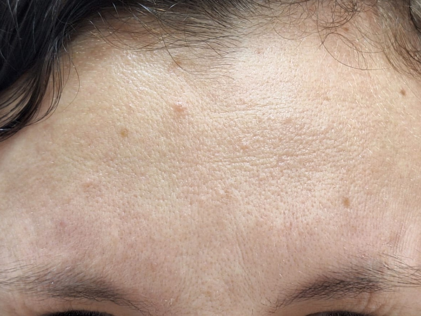 Imagem ilustrativa de equilíbrio facial depois